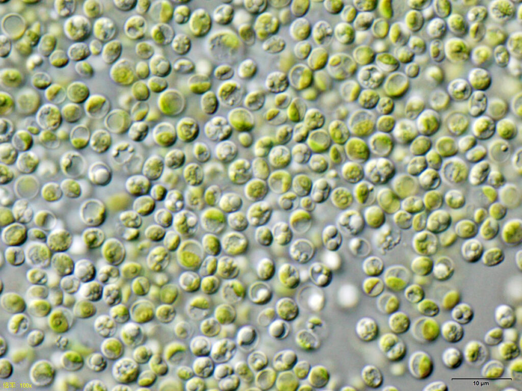 Potensi Mikroalga Chlorella sp.: Mikroorganisme Hijau dengan Segudang Manfaat chlorella vulgaris nies2170