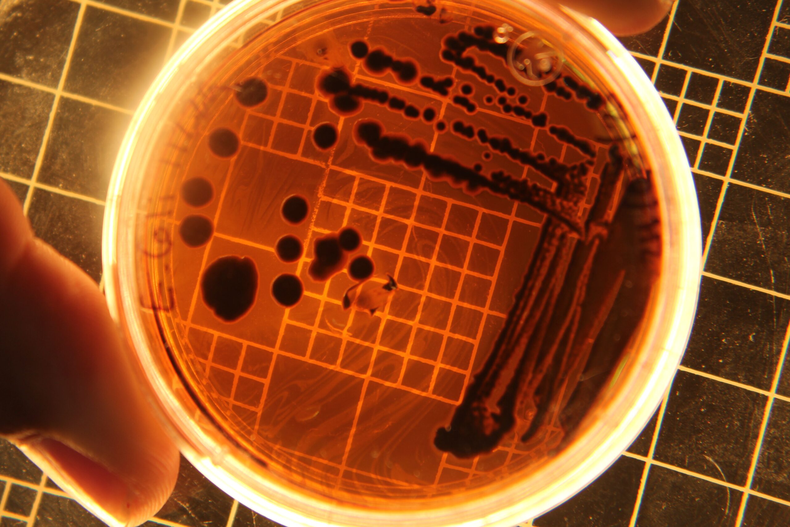 Mengapa Staphylococcus aureus Bisa Sangat Berbahaya? pexels photo 19728524 19728524